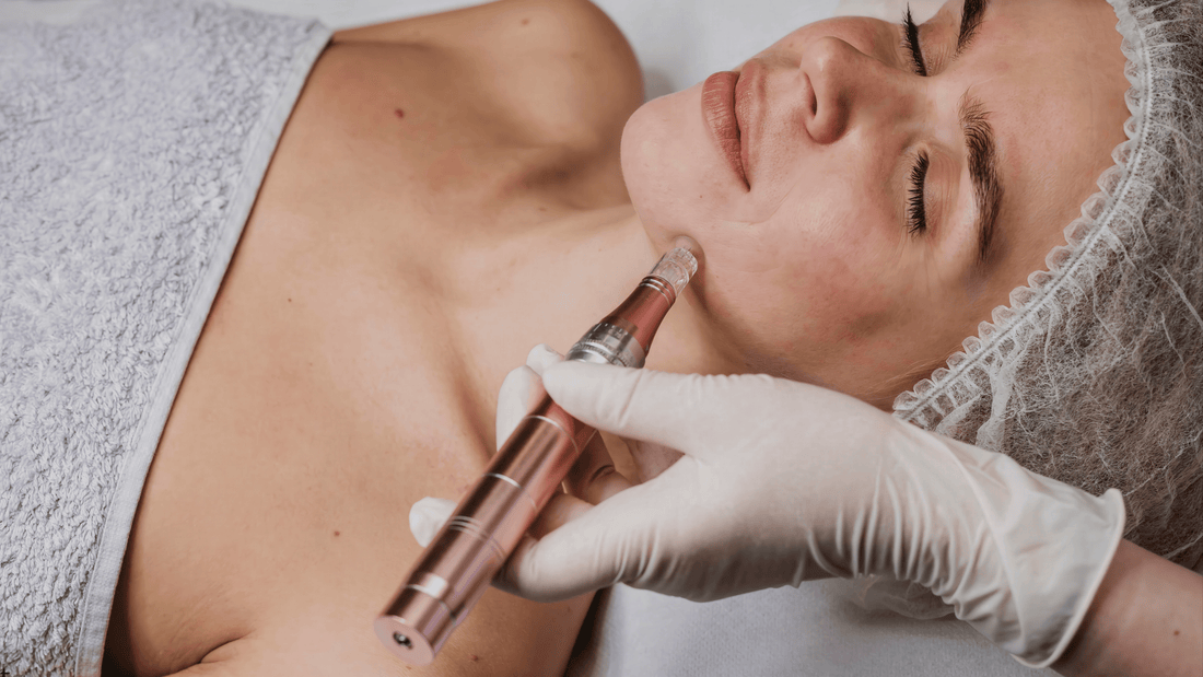 Microneedlingbehandling i ansiktet med dermapen utförd av hudterapeut, närbild som illustrerar om microneedling gör ont och hur behandlingen upplevs på huden