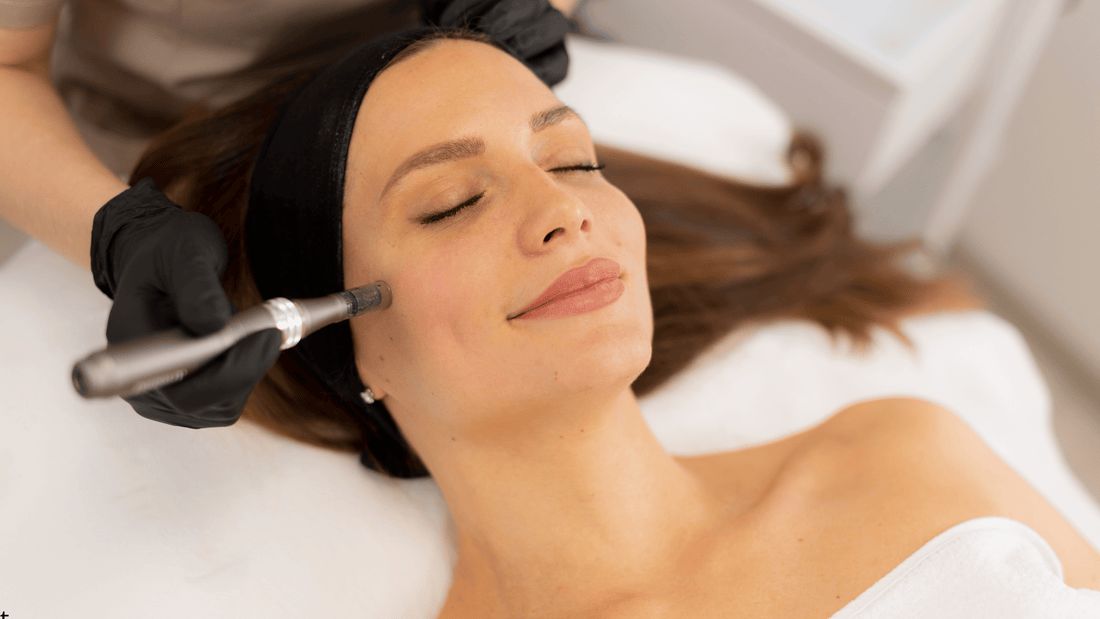 Microneedlingbehandling där en hudterapeut använder en microneedling-penna på kinden för att stimulera hudens förnyelse, kollagenproduktion och förbättra hudens struktur på ett kontrollerat och professionellt sätt.