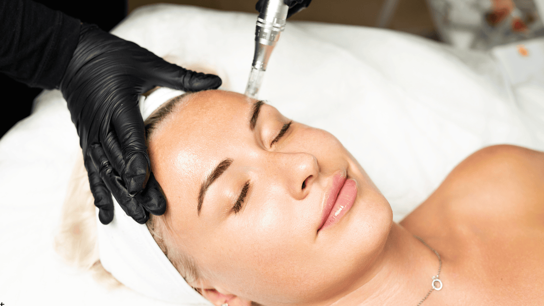 Dermapen-behandling i ansiktet utförd av professionell behandlare med handskar, som stimulerar kollagenproduktion och förbättrar hudens struktur vid microneedling