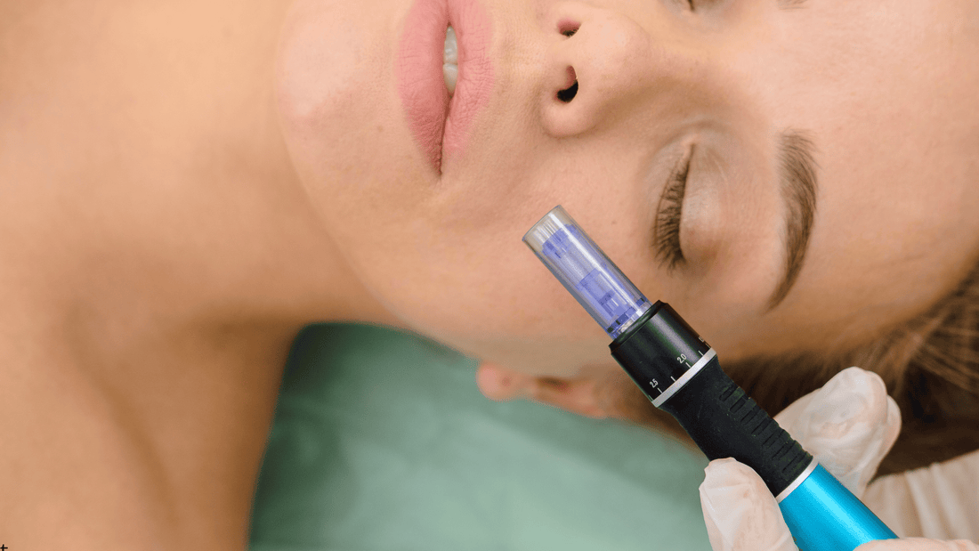 Microneedling-behandling i ansiktet med dermapen – stimulerar kollagenproduktion och förbättrar hudens struktur och lyster.