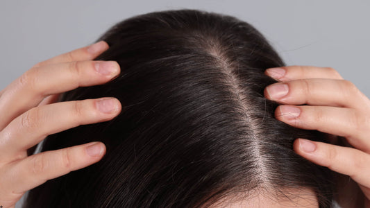Hårbotten med synlig bena, område som kan behandlas med dermastamp vid microneedling för hårväxt.