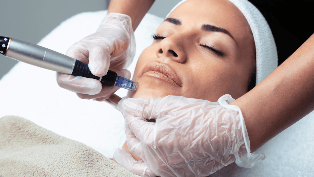 Microneedling-behandling i ansiktet där en hudterapeut använder en microneedling-pen på kinden för att stimulera kollagenproduktion, förbättra hudstruktur och ge jämnare hudton.